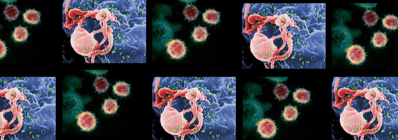 Making sense of the racial divergence of AIDS and COVID-19